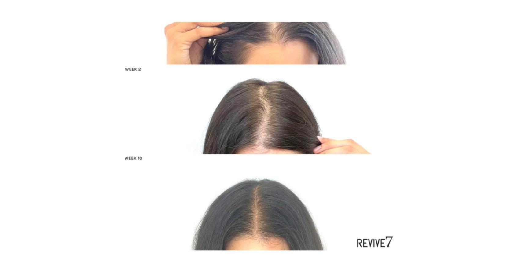 Revive7 Hair Treatment (30ml)